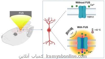 درمان اختلالات عصبی به روش غیرتهاجمی