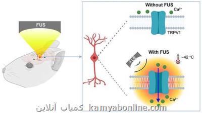 درمان اختلالات عصبی به روش غیرتهاجمی